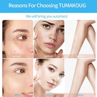 Wrinkle Reducing Wand